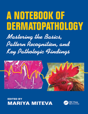 Full Download A Notebook of Dermatopathology: Mastering the Basics, Pattern Recognition, and Key Pathologic Findings - Mariya Miteva | ePub